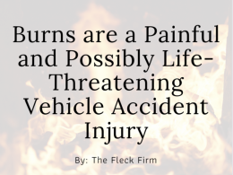 Burns are a painful and life threatening after accident, a car accident lawyer can help